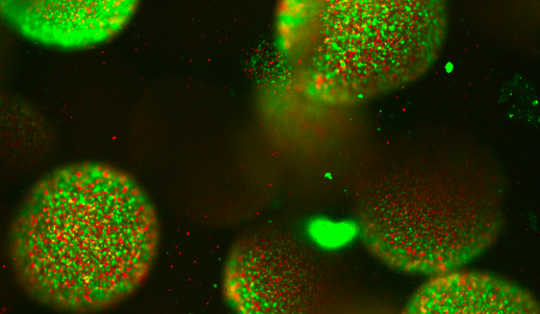 Why Your Kitchen Sponge Is A Bad Choice why kitchen sponge is bad choice2 2 19